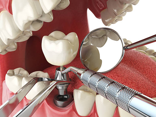 Best Emergency Broken Tooth Repair in Nixon, PA